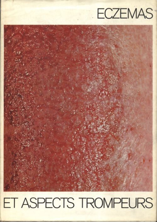 Eczémas et aspects trompeurs - Wolfgang Müller - Livre