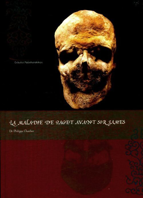 La maladie de Paget avant sir James - Philippe Charlier - Livre