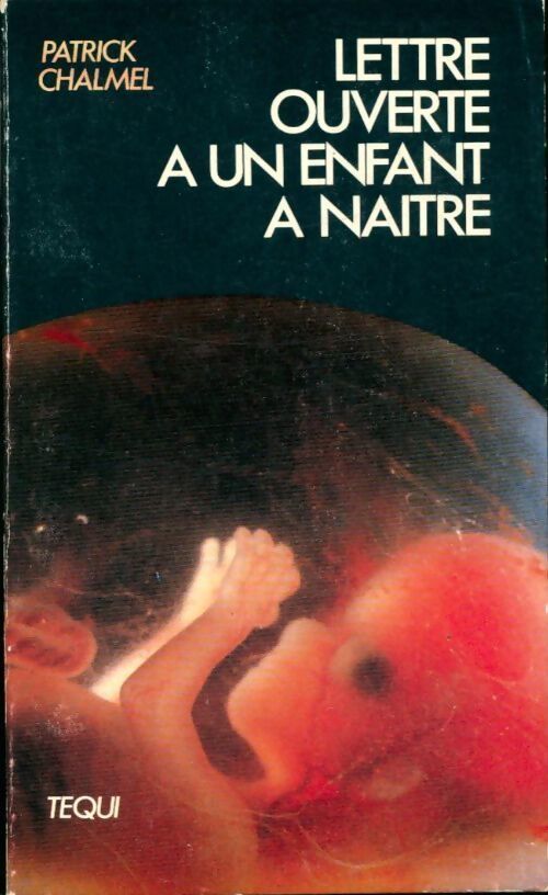 Lettre ouverte à un enfant à naître - Patrick Chalmel - Livre