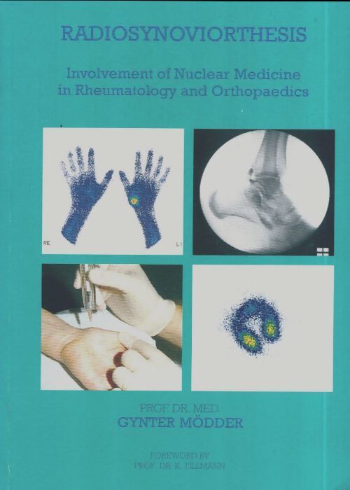 Radiosynoviorthesis Involvement of nuclear medicine in rheumatology and orthopaedics - Gynter Mödder - Livre