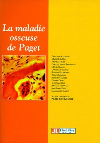 La maladie osseuse de Paget - Collectif - Livre